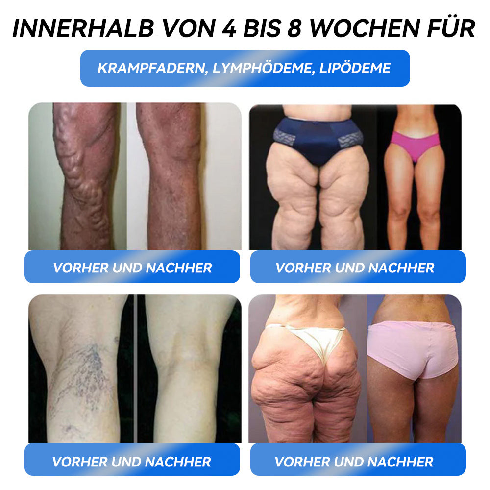 Thonesr® GLP-1 Pro Schlankheits-Trinklösung 7 Tage sichtbare Wirkung, keine Nebenwirkungen, geeignet für alle Altersgruppen 🌹