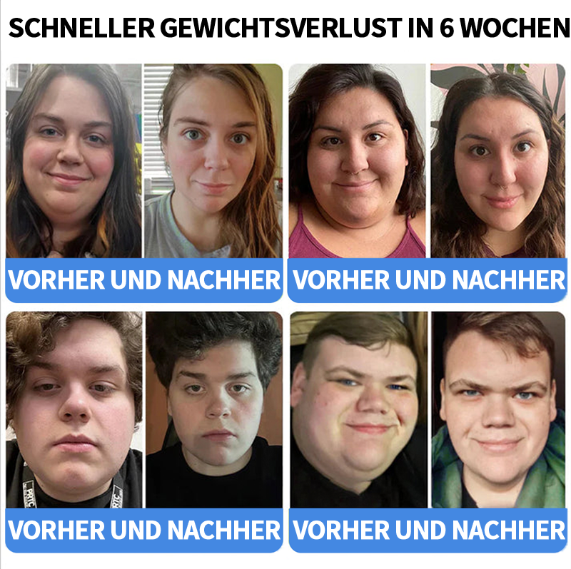 【Letzter Tag Aktion 70 % RABATT】💥 𝑪𝒗𝒓𝒆𝒐𝒛® 𝐍IDDK-Tirzepatid Gewichtsreduktionslösung zum Einnehmen ✅ Einmal alle zwei Tage anwenden | Schnell 20 Pfund abnehmen. Zucker um 90 % reduzieren |)👩‍⚕️