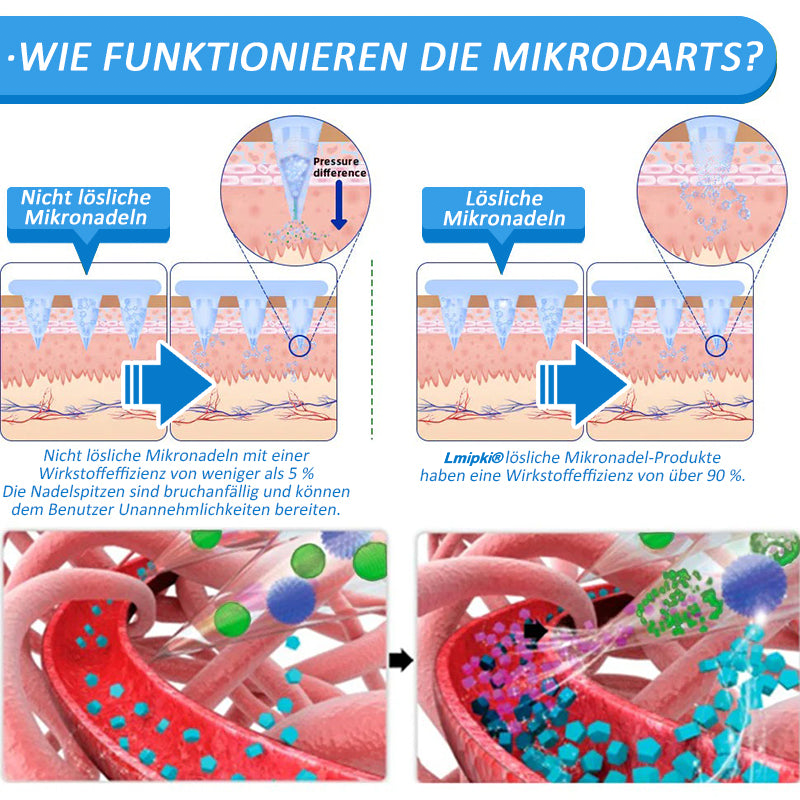 DE Offizieller Laden: Lmipki® 𝐍𝐈𝐃𝐃𝐊-𝐓𝐢𝐫𝐳𝐞𝐩𝐚𝐭𝐢𝐝𝐞 𝐍𝐚𝐧𝐨 Mikronadeln Pflaster（（Balancieren den Blutzucker, schmerzfrei, ohne Nebenwirkungen. Geeignet für Adipositas und Diabetes.）🔄